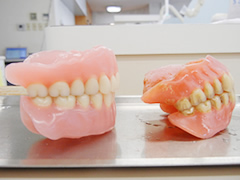 LBO理論、咬合調整の総義歯(入れ歯)比較3