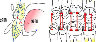 LBO理論、痛くない入れ歯、健康咬合