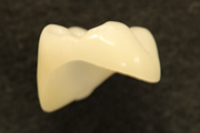 ポーセレンクラウン(セレック使用)