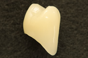 保険適用の小臼歯CADCAM冠（セレック使用）