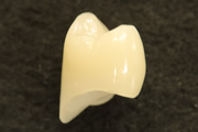 保険適用の小臼歯CADCAM冠（セレック使用）